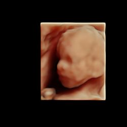 Echo baby 17 weken zwangerschap