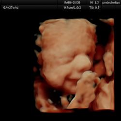 Echo baby 27 weken zwangerschap
