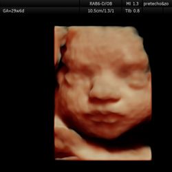Echo baby 30 weken zwangerschap