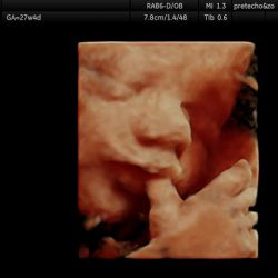 Echo baby 27 weken zwangerschap
